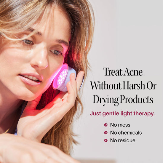 Solawave Bye Acne - Blue and red light therapy device for face and body