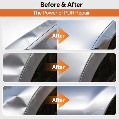 AUTOPDR Paintless Dent Repair Kit for Car, PDR Dent Removal Tools with Dent Lifter & Pro Dent Puller Tabs, Auto Body Dent Puller for Car Dent Repair, Hail Damage Repair