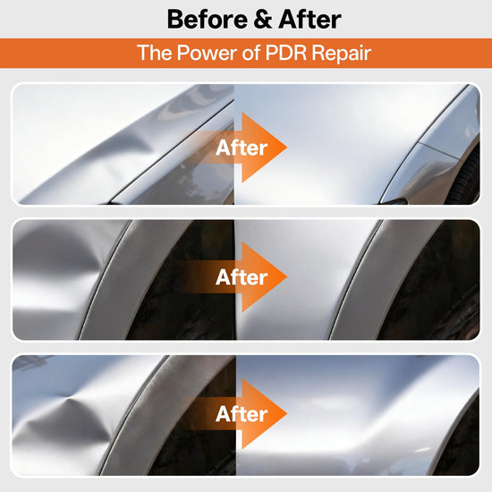 AUTOPDR Paintless Dent Repair Kit for Car, PDR Dent Removal Tools with Dent Lifter & Pro Dent Puller Tabs, Auto Body Dent Puller for Car Dent Repair, Hail Damage Repair