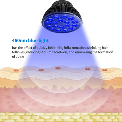 Aumtrly light bulb — 18 LEDs for blue light therapy
