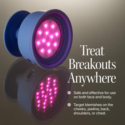 Solawave Bye Acne - Blue and red light therapy device for face and body