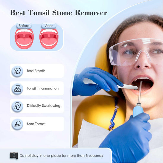 Tonsil Stone Remover with 5X Magnifying Glass Tonsil Stone Removal Kit 3 Suction Modes LED Light Bad Breath Water Flosser