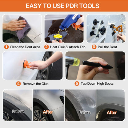 AUTOPDR Paintless Dent Repair Kit for Car, PDR Dent Removal Tools with Dent Lifter & Pro Dent Puller Tabs, Auto Body Dent Puller for Car Dent Repair, Hail Damage Repair