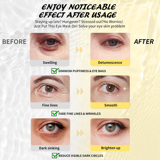 Maskiss under eye patches — collagen eye mask for puffiness and dark circles