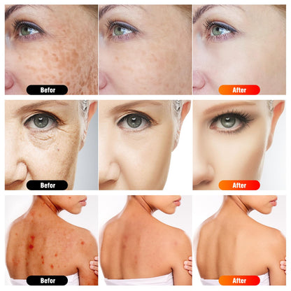 Microcurrent facial machine — 7 in 1 light therapy device with stand and infrared light