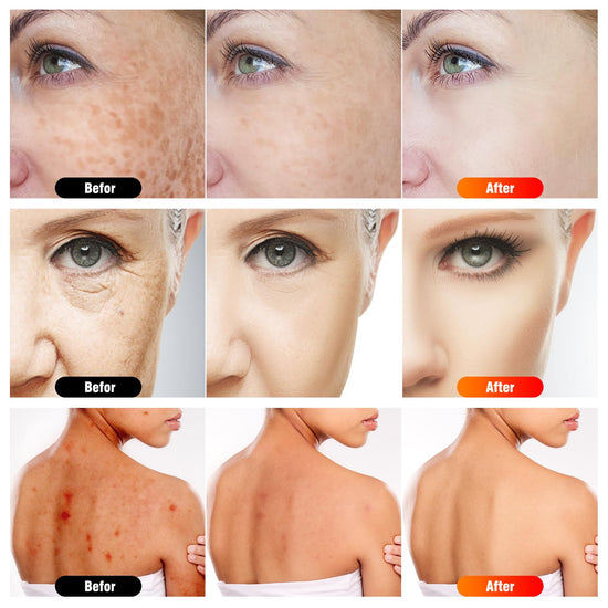 Microcurrent facial machine — 7 in 1 light therapy device with stand and infrared light