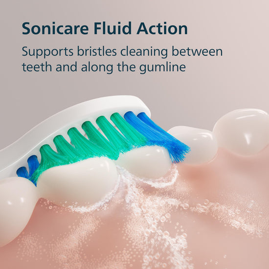 Philips Sonicare electric toothbrush — sonic technology with Smartimer and Quadpacer