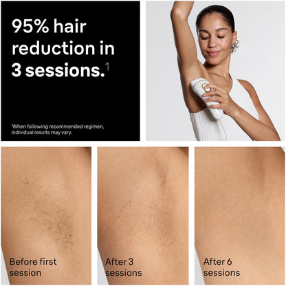Braun epilator - at home IPL hair removal system