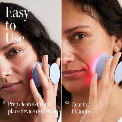 Solawave Bye Acne - Blue and red light therapy device for face and body