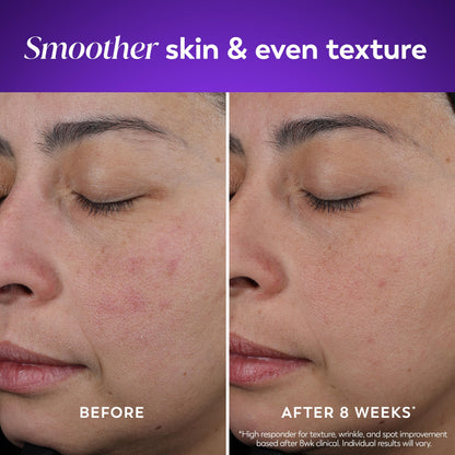 Olay skin moisturizer — retinol formula